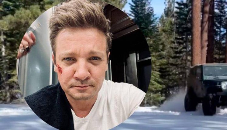 Actor Jeremy Renner, el Ojo de Halcón, se encuentra en estado crítico tras sufrir accidente